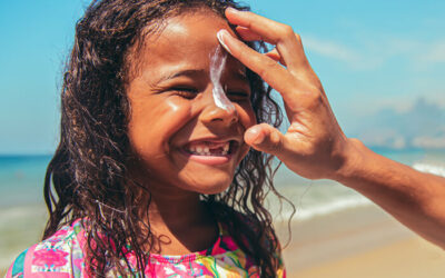 Sun Safety: How to Prevent Sunburn