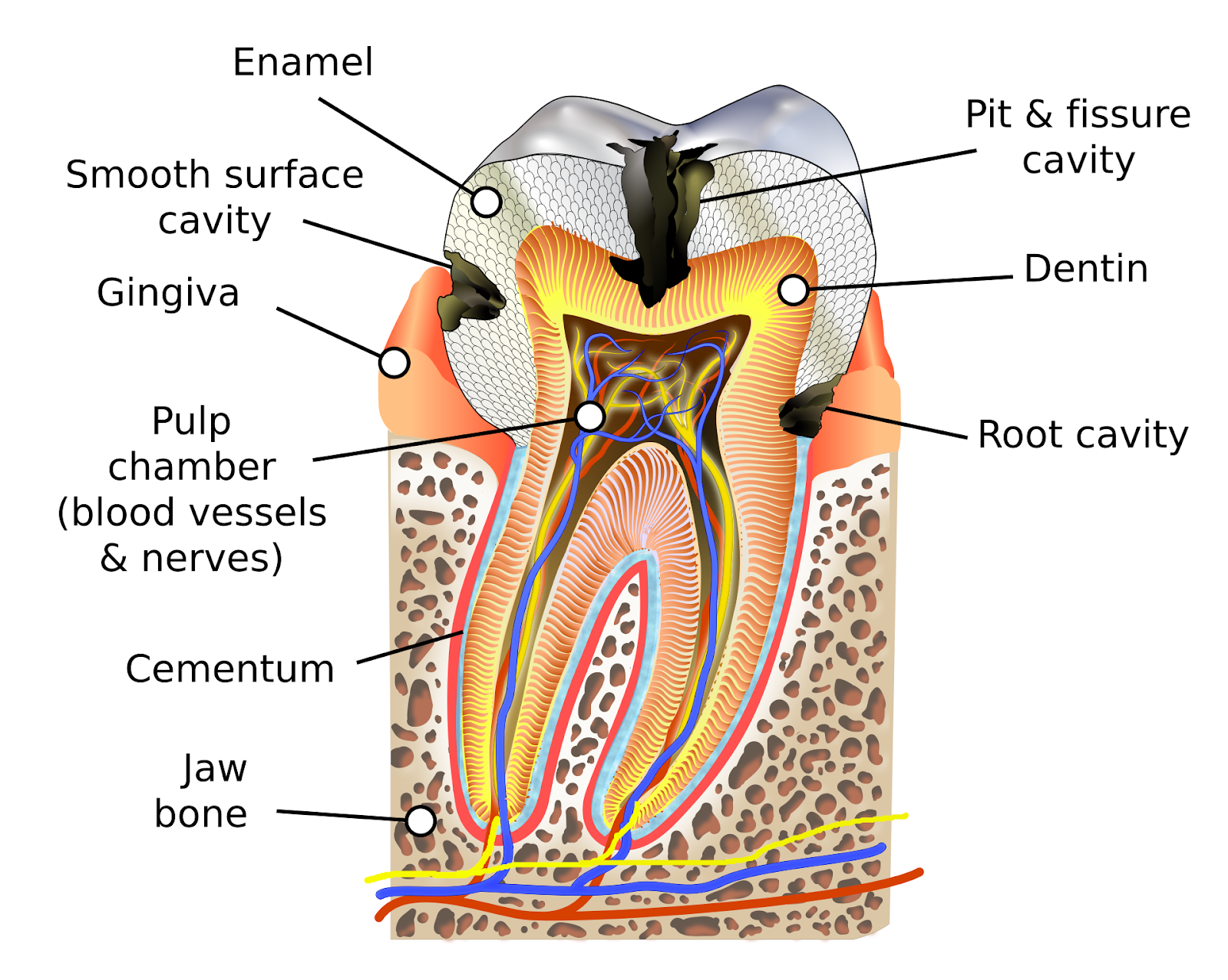 Illustrative picture of cavity between teeth